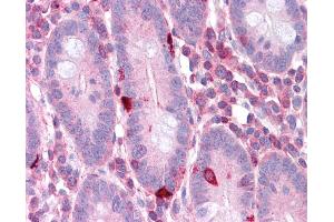 EEF2 antibody was used for immunohistochemistry at a concentration of 4-8 ug/ml. (EEF2 antibody  (N-Term))