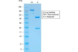 SDS-PAGE Analysis Purified gp100 Rabbit Recombinant Monoclonal Antibody (PMEL/1825R). (Recombinant Melanoma gp100 antibody)