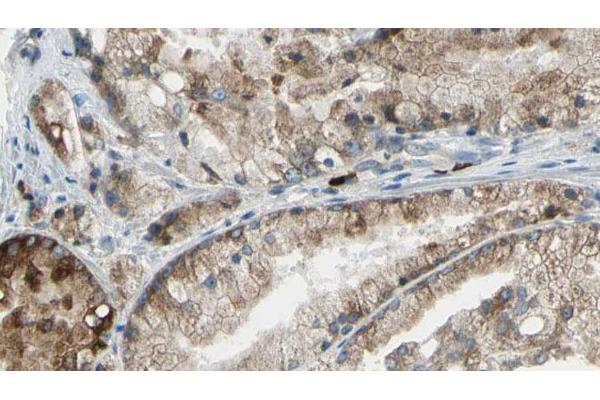 SLC34A2 antibody  (N-Term)