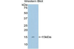 Western Blotting (WB) image for anti-Keratin 2 (KRT2) (AA 7-160) antibody (ABIN1859577) (Keratin 2 antibody  (AA 7-160))