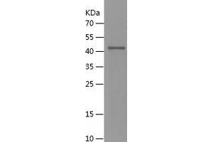 Western Blotting (WB) image for Synovial Sarcoma, X Breakpoint 4 (SSX4) (AA 1-188) protein (His-IF2DI Tag) (ABIN7283657) (SSX4 Protein (AA 1-188) (His-IF2DI Tag))