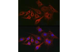 Immunofluorescence analysis of C6 cells using α-Tubulin Mouse mAb (ABIN7271035) at dilution of 1:100 (40x lens). (TUBA4A antibody)