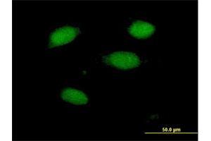 Immunofluorescence of purified MaxPab antibody to PRKRIR on HeLa cell. (PRKRIR antibody  (AA 1-150))