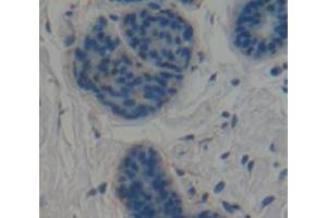 IHC-P analysis of Human Tissue, with DAB staining. (CNN1 antibody  (AA 1-268))