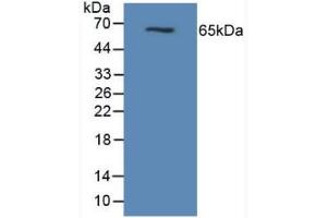 Figure. (MUC1 antibody  (AA 474-630))