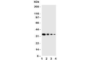 Western blot testing of PKR antbody;  Lane 1: Recombinant human protein 10ng;  2: 5ng;  3: 2. (EIF2AK2 antibody  (N-Term))