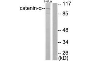 Western blot analysis of extracts from HeLa cells, using Catenin-alpha1 Antibody. (CTNNA1 antibody  (AA 857-906))