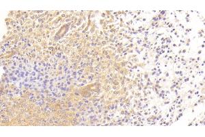 Detection of TGFbR3 in Mouse Uterus Tissue using Polyclonal Antibody to Transforming Growth Factor Beta Receptor III (TGFbR3) (TGFBR3 antibody  (AA 469-724))