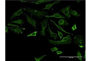 Immunofluorescence (IF) image for anti-Testis-Specific Serine Kinase 3 (TSSK3) (AA 1-268) antibody (ABIN566476)