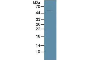 Rabbit Capture antibody from the kit in WB with Positive Control: Human tibia lysate. (MMP13 CLIA Kit)