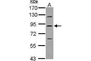 WB Image Sample (30 ug of whole cell lysate) A: U87-MG 7. (PLA2G6 antibody)