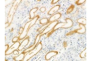 anti-Chondroitin Polymerizing Factor (CHPF) (C-Term) antibody