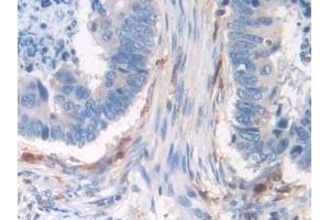 Immunohistochemistry (IHC) image for anti-Interferon, gamma-Inducible Protein 30 (IFI30) (AA 1-250) antibody (ABIN7435856)