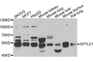 Western blot analysis of extracts of various cell lines, using SPTLC1 antibody (ABIN5974083) at 1/1000 dilution. (SPTLC1 antibody)