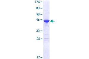 MED18 Protein (AA 1-208) (GST tag)