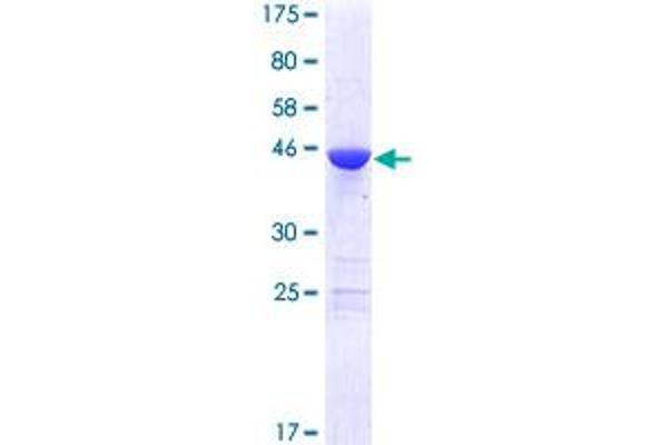 MED18 Protein (AA 1-208) (GST tag)