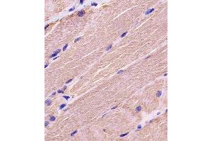 Antibody staining MYBPC3 in human skeletal muscle tissue sections by Immunohistochemistry (IHC-P - paraformaldehyde-fixed, paraffin-embedded sections). (MYBPC3 antibody  (N-Term))