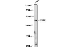 Western blot analysis of extracts of HeLa cells, using M1 antibody (ABIN6129914, ABIN6136958, ABIN6136959 and ABIN6218150) at 1:500 dilution. (AP2M1 antibody  (AA 134-433))