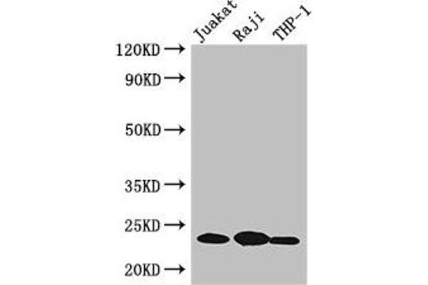 ARHGDIB antibody  (AA 2-86)