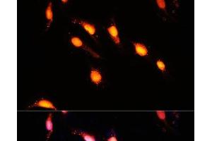 Immunofluorescence analysis of U-2 OS cells using GTF3C4 Polyclonal Antibody at dilution of 1:100 (40x lens). (GTF3C4 antibody)