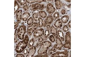 Immunohistochemical staining of human kidney with ZFAND2B polyclonal antibody  shows strong cytoplasmic and nuclear positivity in cells in tubules at 1:10-1:20 dilution.