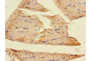Immunohistochemistry of paraffin-embedded human skeletal muscle tissue using ABIN7153920 at dilution of 1:100 (SLC37A1 antibody  (AA 245-302))