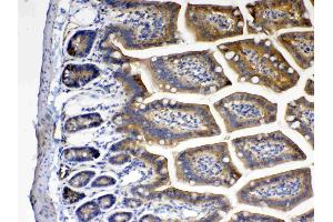 IHC analysis of CD151 using anti- CD151 antibody . (CD151 antibody  (AA 113-175))