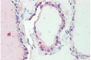 Human Thyroid: Formalin-Fixed, Paraffin-Embedded (FFPE) (Sp2 antibody  (AA 180-229))