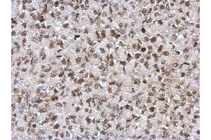 Image no. 1 for anti-Sin3A-Associated Protein, 130kDa (SAP130) (N-Term) antibody (ABIN1494118) (SAP130 antibody  (N-Term))