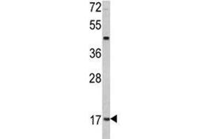 Western blot analysis of Leptin antibody MDA-MB231 lysate. (Leptin antibody  (AA 134-166))