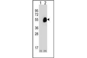 Western blot analysis of GCDH (arrow) using GCD / GCDH Antibody (C-term) Cat.