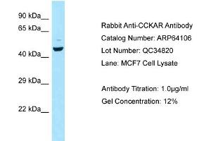 Western Blotting (WB) image for anti-Cholecystokinin A Receptor (CCKAR) (C-Term) antibody (ABIN2789733) (CCKAR antibody  (C-Term))