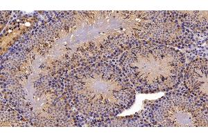 Detection of PLA2G2D in Mouse Testis Tissue using Polyclonal Antibody to Phospholipase A2, Group IID (PLA2G2D) (PLA2G2D antibody  (AA 21-144))