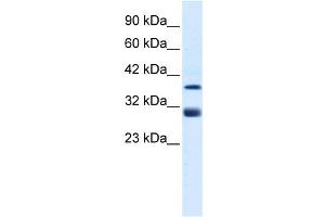 WB Suggested Anti-TAL1 Antibody Titration:  0. (TAL1 antibody  (Middle Region))