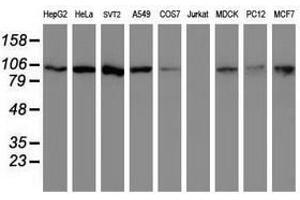 Image no. 2 for anti-Cullin 4B (CUL4B) (AA 1-300) antibody (ABIN1490726) (Cullin 4B antibody  (AA 1-300))