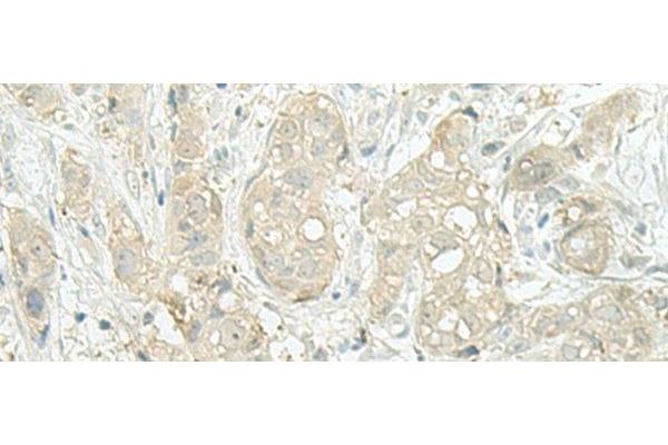 C17orf37 antibody