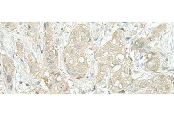 C17orf37 antibody