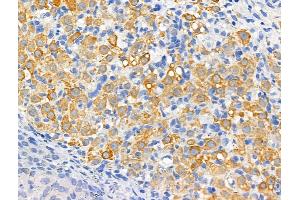 ABIN6261404 and ABIN6266530 at 1/100 staining Rat ovarian tissue by IHC-P. (Dysferlin antibody  (C-Term))
