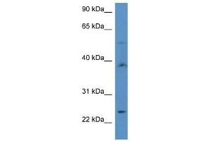 Western Blot showing ACOT9 antibody used at a concentration of 1 ug/ml against MDA-MB-435S Cell Lysate