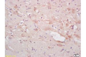 Formalin-fixed and paraffin embedded rat brain labeled with Rabbit Anti NF66/alpha Internexin Polyclonal Antibody, Unconjugated (ABIN739830) at 1:200 followed by conjugation to the secondary antibody and DAB staining