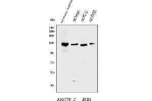 Western blot analysis of Bub1 using anti-Bub1 antibody (ABIN7601640).
