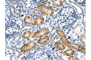 P2RX2 antibody was used for immunohistochemistry at a concentration of 4-8 ug/ml to stain Epithelial cells of renal tubule (arrows) in Human Kidney. (P2RX2 antibody  (Middle Region))