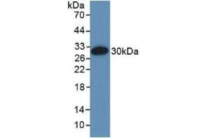 Detection of Recombinant EMILIN1, Rat using Polyclonal Antibody to Elastin Microfibril Interface Located Protein 1 (EMILIN1)