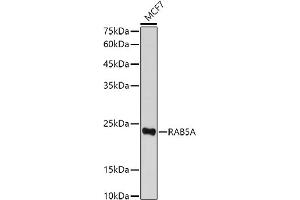 Western blot analysis of extracts of MCF7 cells, using RA antibody (ABIN3021646, ABIN3021647, ABIN3021648 and ABIN1513457) at 1:500 dilution. (RAB5 antibody  (AA 1-215))