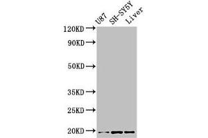 Western Blot Positive WB detected in: U87 whole cell lysate, SH-SY5Y whole cell lysate, Mouse liver tissue All lanes: TSLP antibody at 3. (Thymic Stromal Lymphopoietin antibody  (AA 29-159))