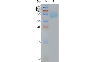 SDS-PAGE (SDS) image for Adenosine A2a Receptor (ADORA2A) protein (ABIN7491539)