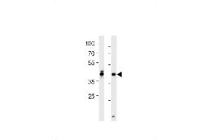 DANRE hoxa1a Antibody (Center) Azb10012a western blot analysis in zebra fish brain and heart tissue lysates (35 μg/lane). (HOXA1A antibody  (AA 192-219))