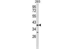 Western blot analysis of CSGALNACT2 Antibody (Center) in 293 cell line lysates (35ug/lane). (CSGALNACT2 antibody  (Middle Region))