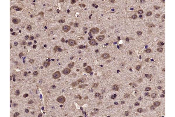 TYK2 antibody  (pTyr1054, pTyr1055)