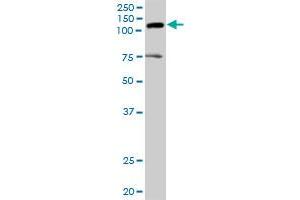 AXL MaxPab rabbit polyclonal antibody. (AXL antibody  (AA 1-894))